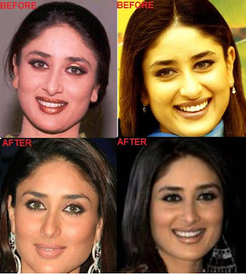 Kareena Kapoor Plastic Surgery on Kareena Kapoor Plastic Surgery   Kareena Kapoor Hot Pics