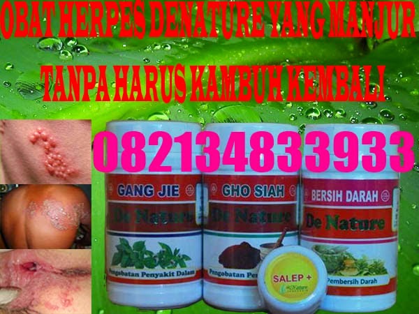 Obat Herpes Yang Bagus