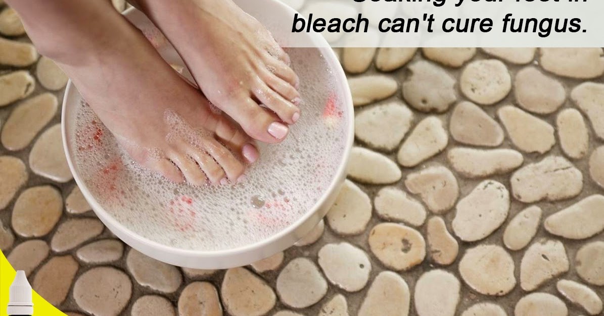 SkinCureFungisol: TOENAIL FUNGUS? I- FUNGISOL MO!