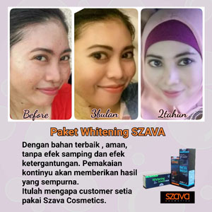 Paket Whitening 350 ribu