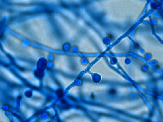 Blastomyces; blastomyces dermatitidis