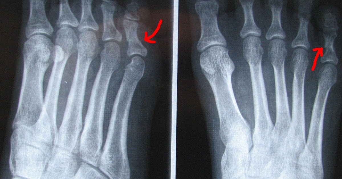 Il Blog Di Bio Ideeinattesadi Incaute Manovre Tra Gli Scogli Domestici