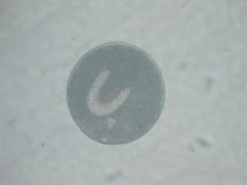 AcuarioBlogSencillo Ichthyophthirius Multifiliis, Punto Blanco