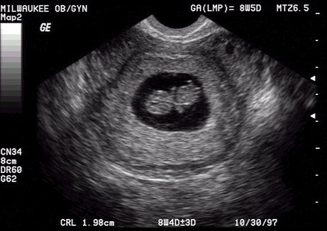 Passion For Life July 2011