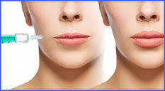 Botox Cosmetic Treatments