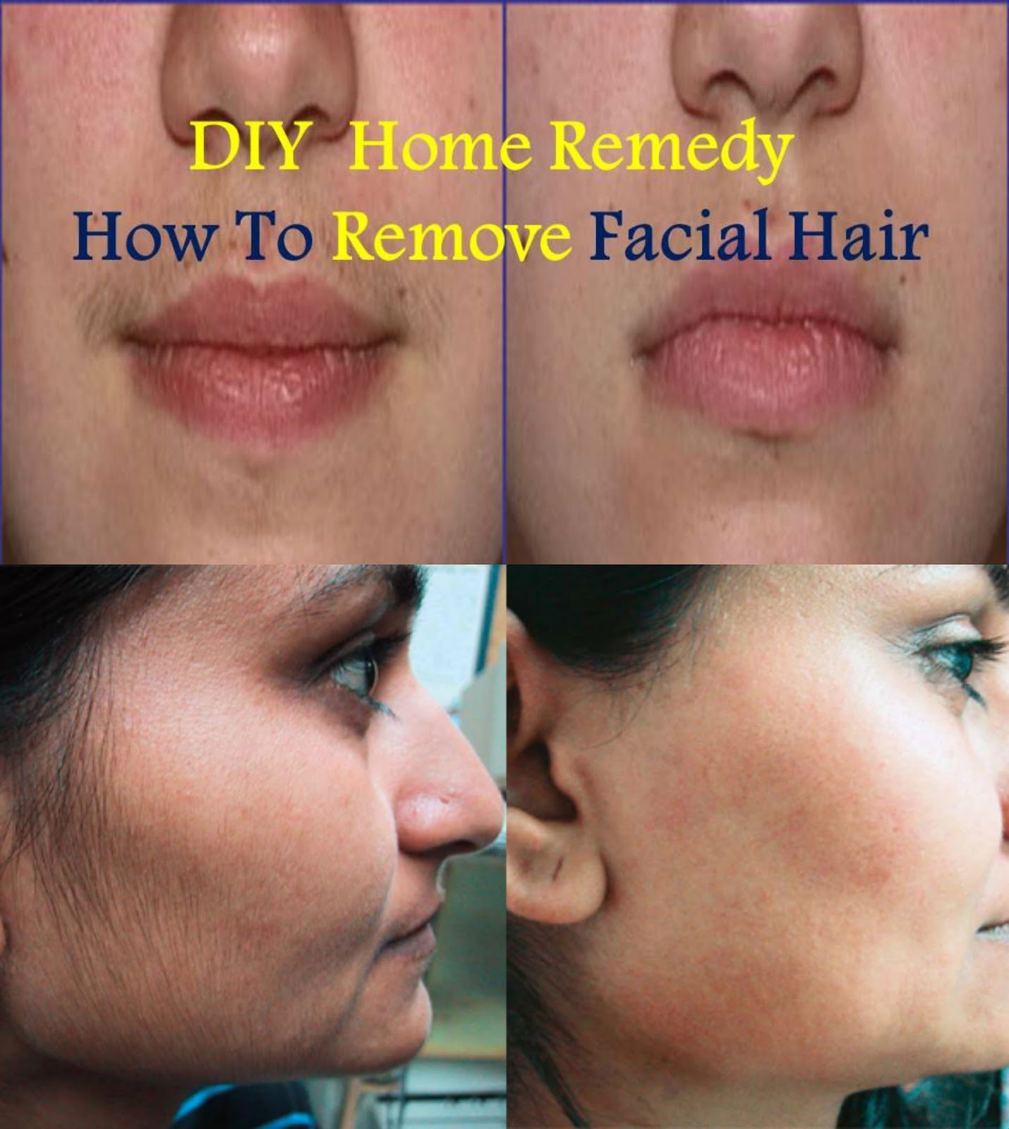 What are some home remedies to remove facial hair?