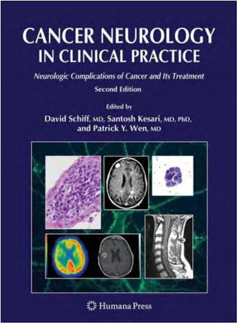 Cancer Neurology in Clinical Practice: Neurologic Complications of Cancer and Its Treatment 
