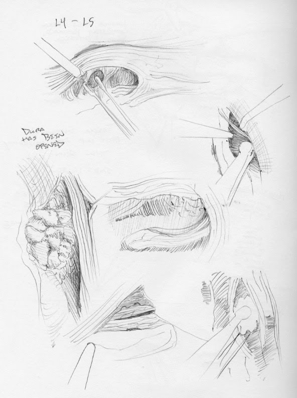 Dissertation vs thesis image