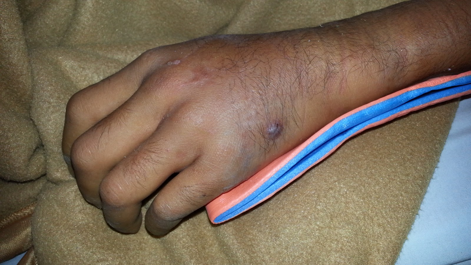 The View from Erik Travels' World Snake Bite Sunday