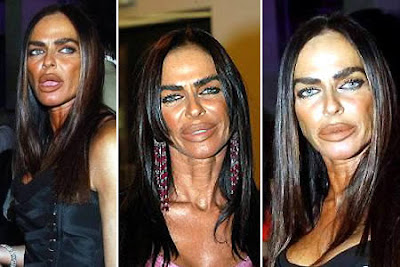 Can you imagine how ugly this photo looks after the plastic surgery gone wrong? This photo abviously tells that this lady's entire facial surgery gone wrong, pay extra attention to compare single parts of her face. which part of the facial is the worst? Now we can think of a barbie doll'sface in  comparison   to this.