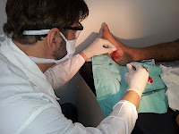 Dr Felipe realiza procedimento no pé do jovem paciente.
