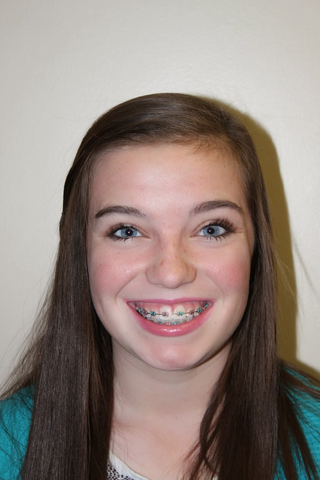 The Bowen Family Emily turns 14 and gets her braces off