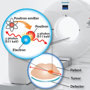 Does A Pet Scan Show Cancer Cells