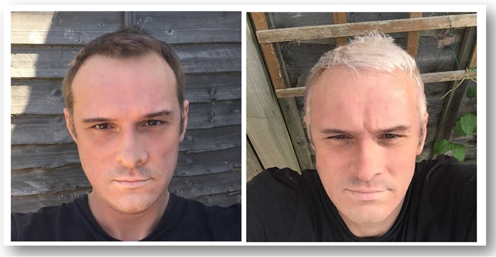 Scott Cornwall Hair Expert Shades Of Grey Part 2