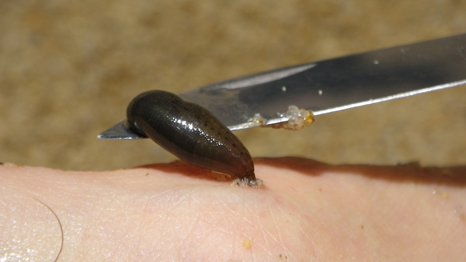 Survival Guide for Expat Aid Workers How to remove a leech