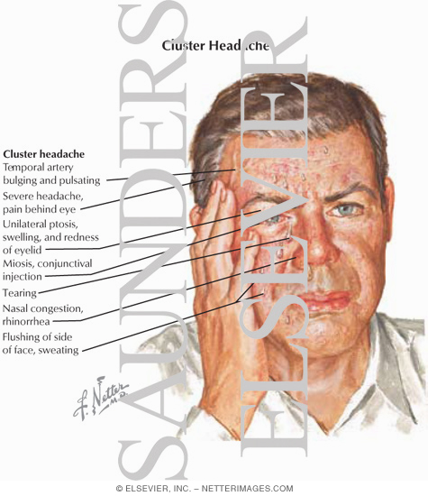 is verapamil good for cluster headaches