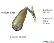 calculos biliares.
