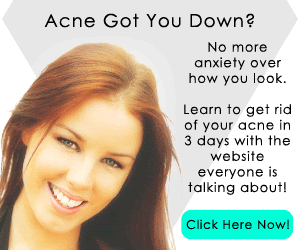 Acne Got You Down?