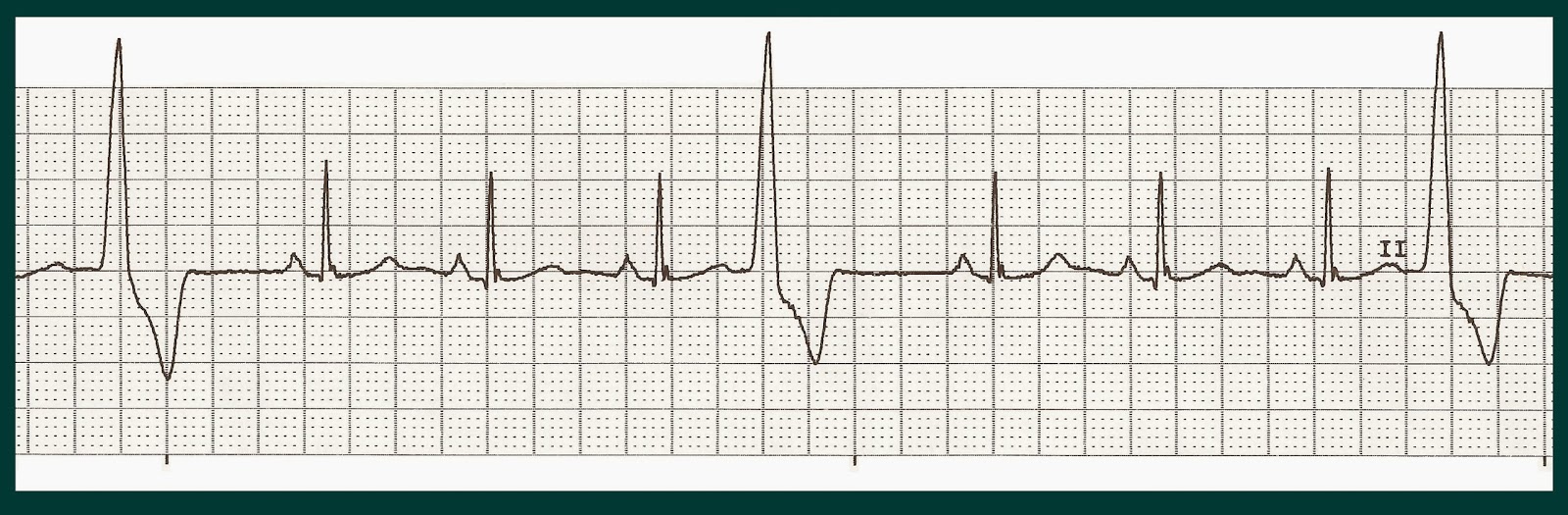 cath lab nurse