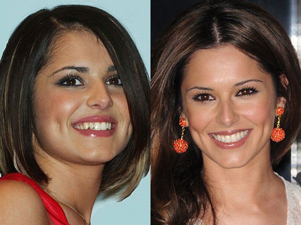 cheryl+cole+before+and+after.jpg