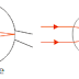 Causes of Farsightedness