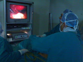 Laparoscopy