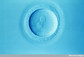 Fertilized Human Egg A newly fertilized human ovum. Wellcome Images