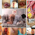 Wasir Bengkak Cepat Sembuh Dengan Obat Tradisional thumbnail