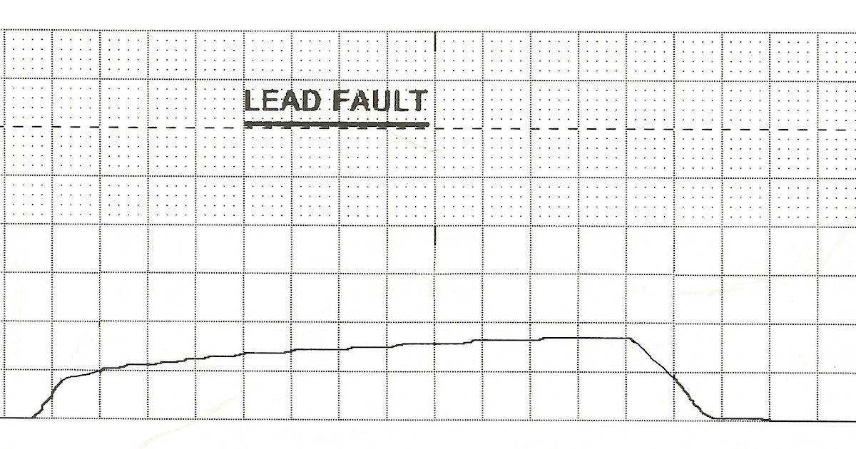 Float Nurse Continuous Waveform Capnography