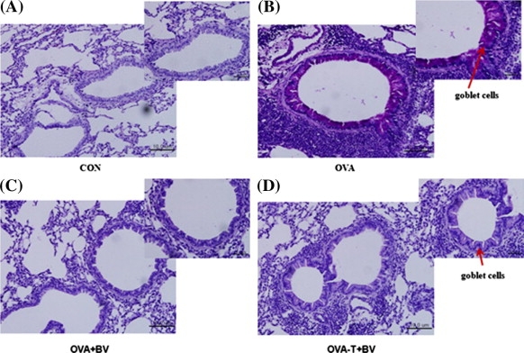 Flagyl Increases Risk Of Herpes