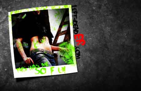 Lfd2+spitter