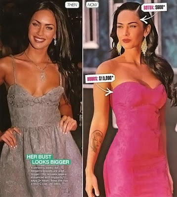 Megan Fox plastic surgery