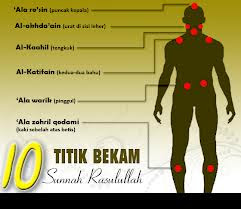 Bekam Sunnah Thibbun Nabawi