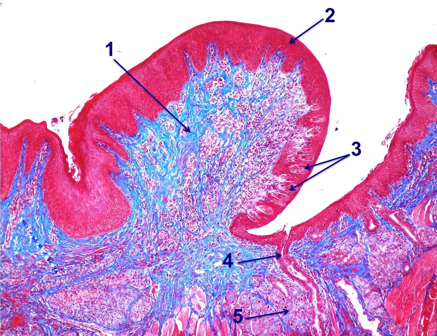 SOS BIOLOGIA CELULAR Y TISULAR DIGESTIVO. LENGUA. PAPILAS CALICIFORMES