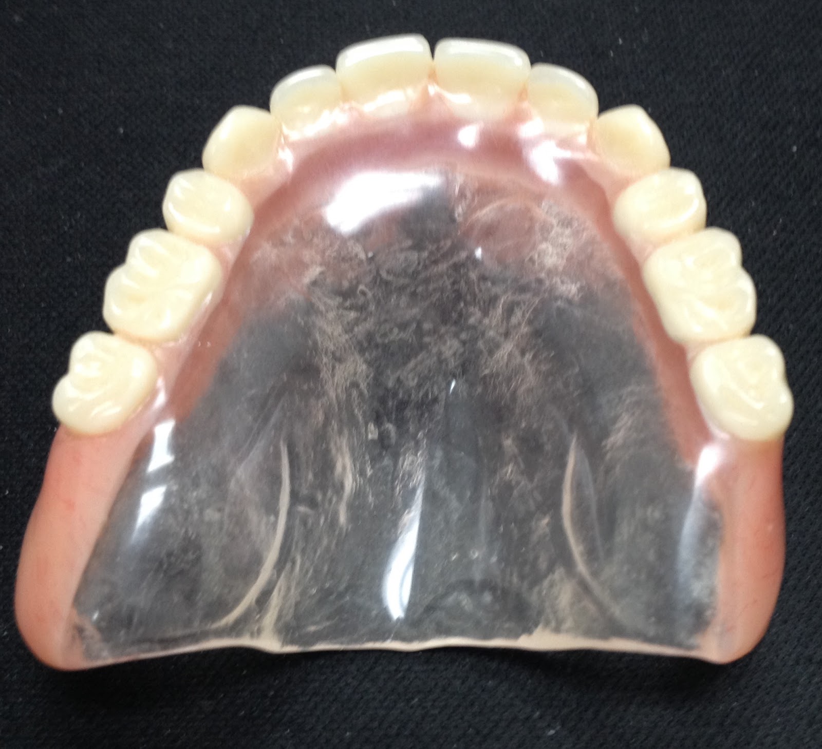 Le blogue Michel Puertas denturologiste Prótesis Dentales Completas