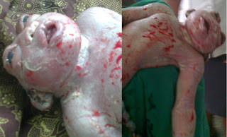 NIgerian Woman Delivers Frog-Baby 1