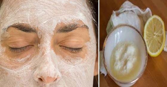 El champú hv contra la caída de los cabello