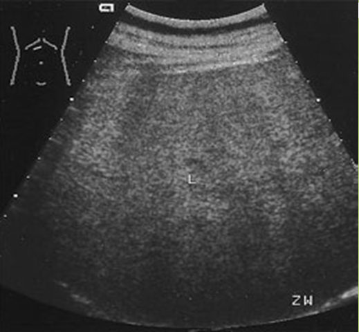 MBBS Medicine (Humanity First): Liver Ultrasound