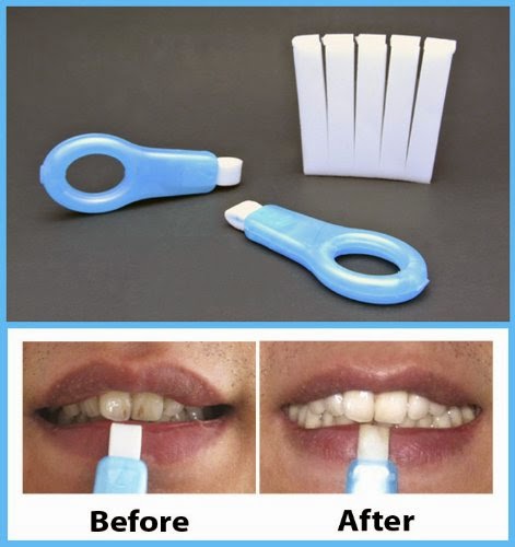 http://www.ebay.co.uk/itm/SmileStiX-Pre-Teeth-Whitening-Kit-For-Stain-Removal-/131427360358?roken=cUgayN