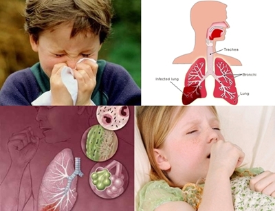 Cara Mengatasi Penyakit ISPA Pada Anak | Obat Herbal Untuk Anak