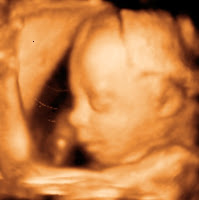 27 Week Ultrasound