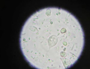 La medicina pública de los parásitos con la ayuda por la agua oxigenada