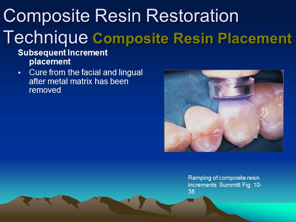 Dentistry Composite Resin