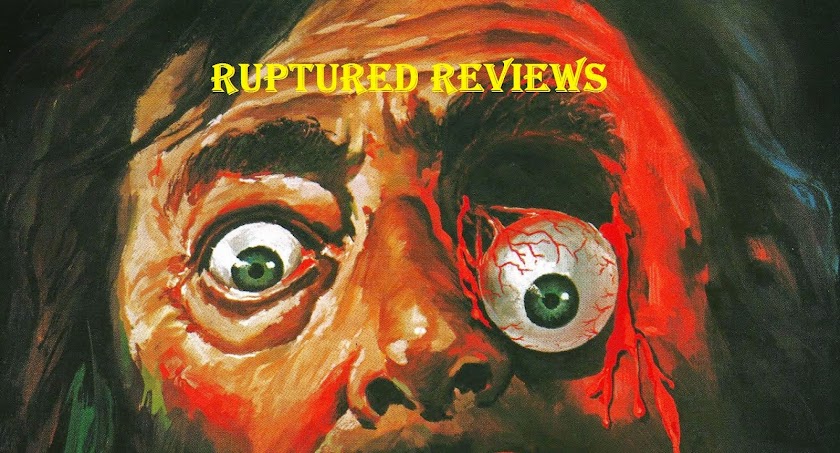 Ruptured Reviews 