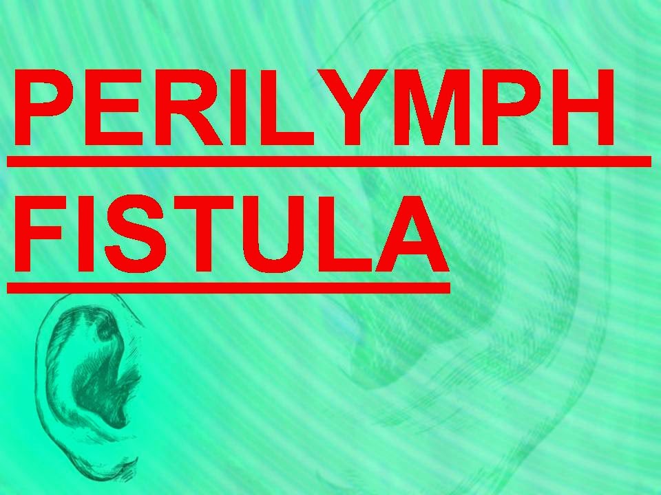 المدونة الطبية د.فهيد سالم السبيعي PERILYMPH FISTULA