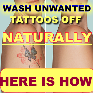 Easy Tattoo Removal Methods