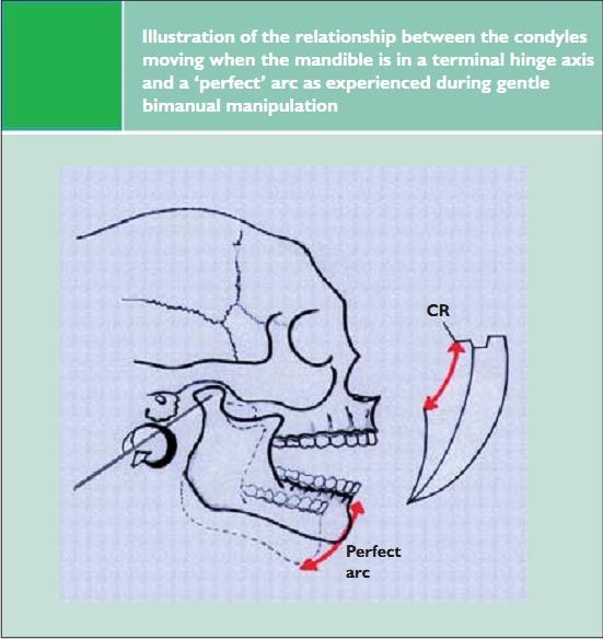 Dentistry lectures for MFDS/MJDF/NBDE/ORE: A Note ... posselt s diagram 