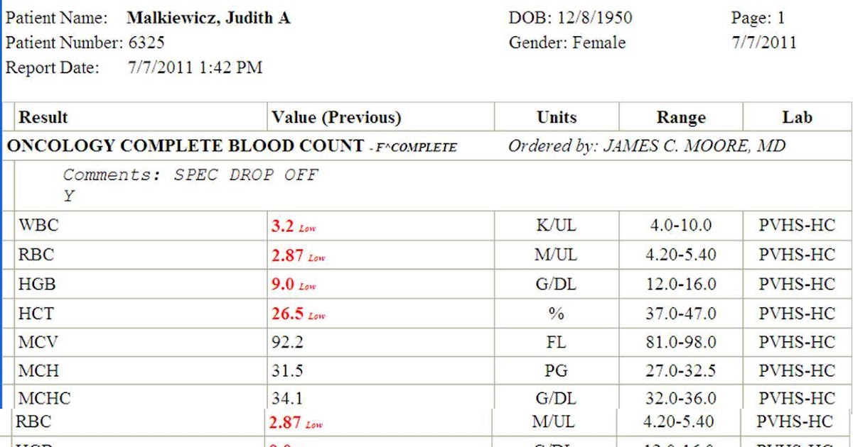 jm's Adventure with Multiple Myeloma CBC with Differential just before