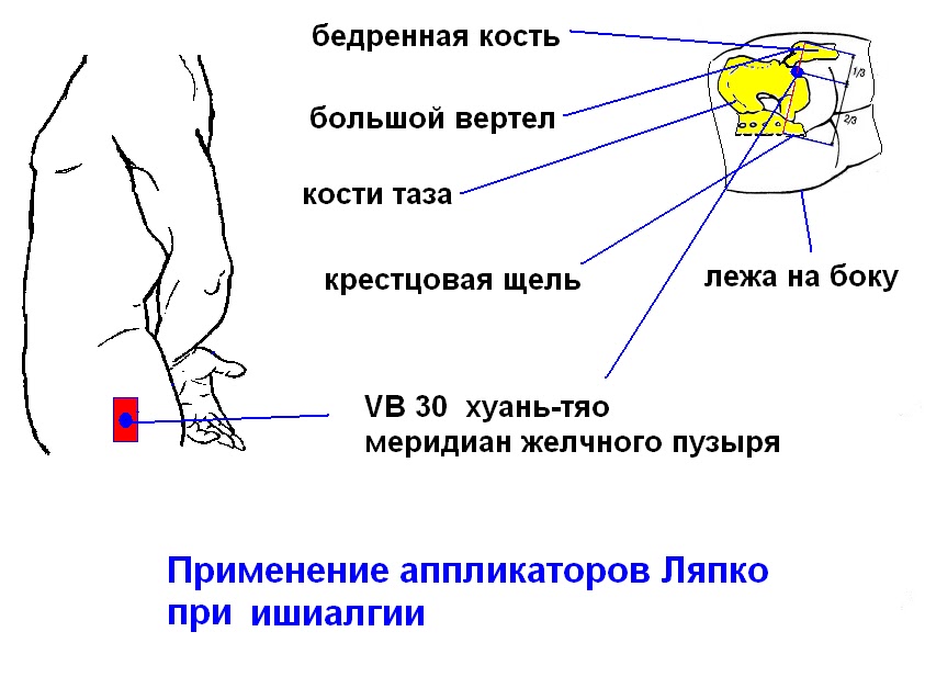 Цистит боли в теле Цистит боли в теле