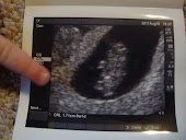 Baby #2's First Picture!
